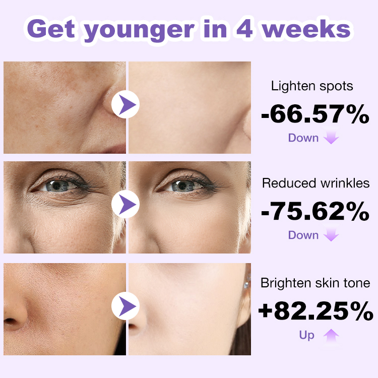 100% ORIGINAL ELLEN ELLA Anti-Aging Triple Retinol Face Cream And Serum-Add 100 pesos to get a combo